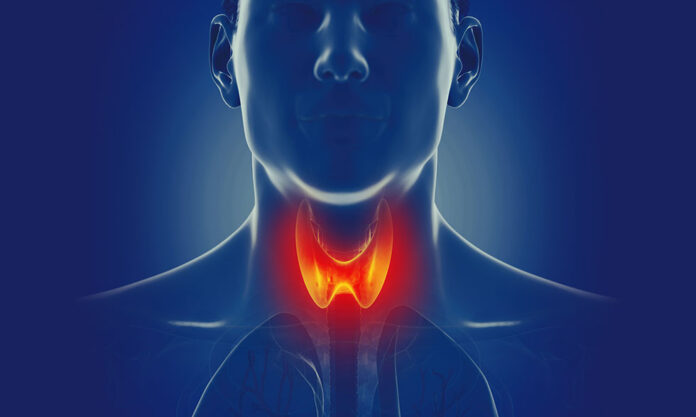 hypothyroidism