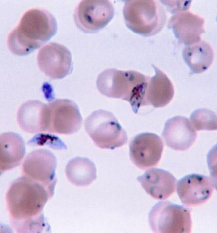Plasmodium